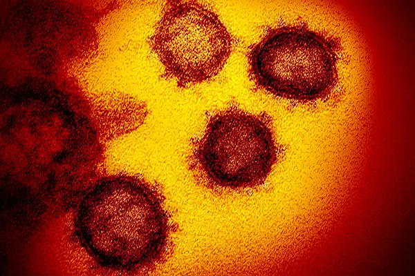 Coronavirus1