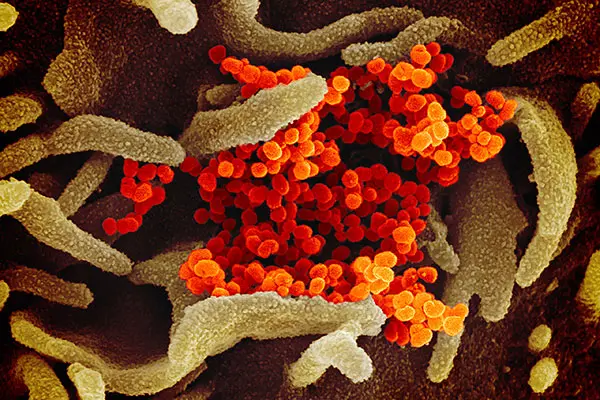 Coronavirus2